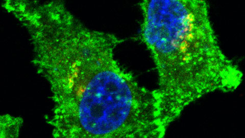  imagen de un cultivo celular expresando la proteina TREM2 (en verde)