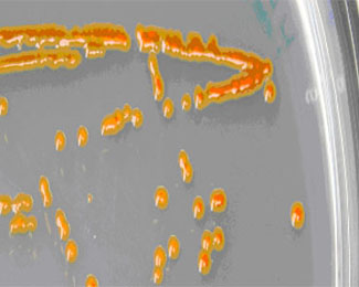Colònies de Polaribacter sp.MED152 creixent en placa 