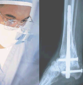 foto traumatologia