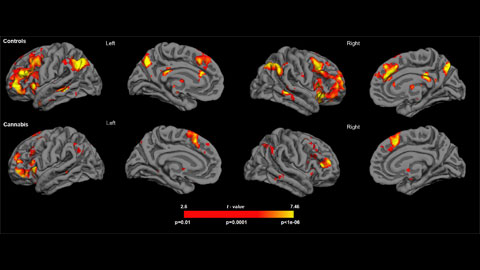 Cannabis Consumers Show Greater Susceptibility to False Memories