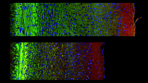 Estudian las funciones de la proteína PDK1 en las neuronas cerebrales de ratones