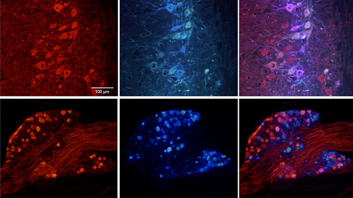 imatges al microscopi de les neurones de ratolí