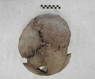 Crani parcialment reconstruït al laboratori