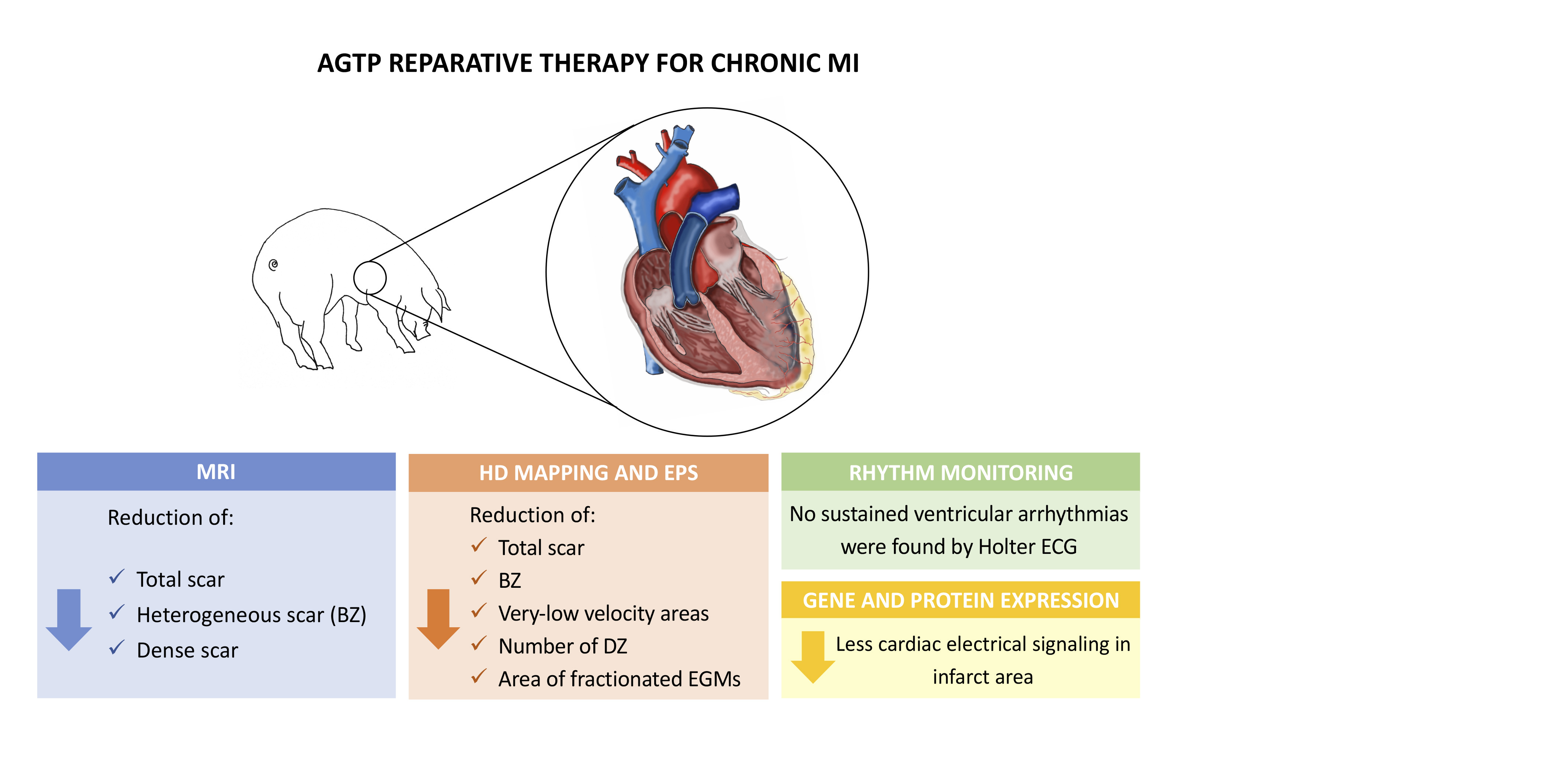 diagram explaining the improvements of the heart after AGTP therapy