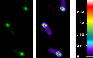 Cossos d'inclusió bacterians