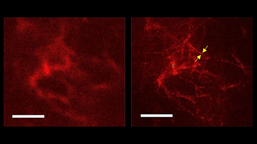 Plaques Amiloides amb microscopia confocal (esq.) i STED (dreta)