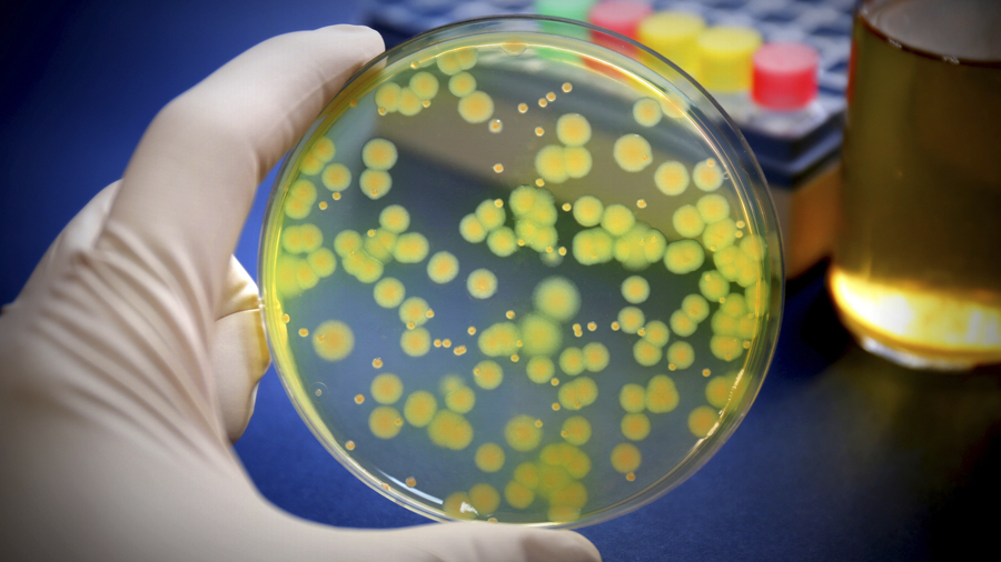 Placa amb el bacteri Pseudomonas aeruginosa