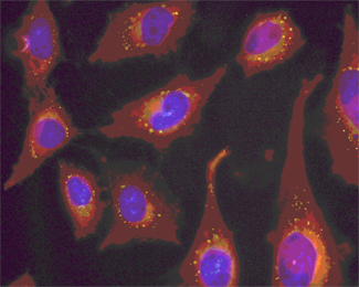 Gotetes lipídiques (LD) en cèl·lules CHO