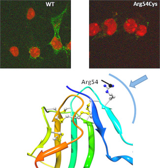 Hormona anti-mülleriana