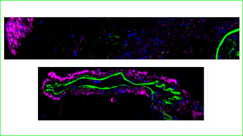 Paper de l'esfingosina en el flux sanguini cerebral