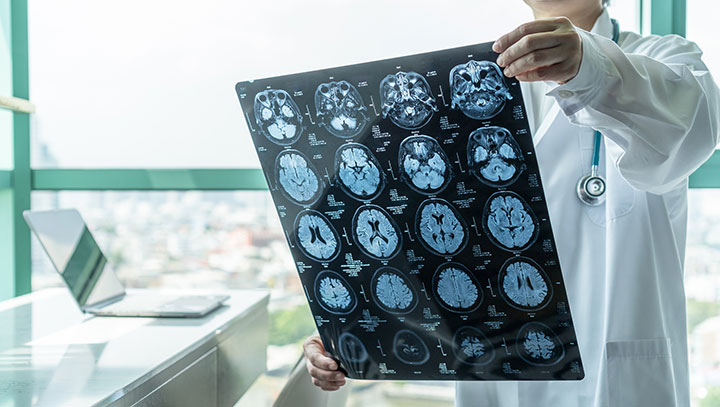 Neuropsicologia i Neurologia de la Conducta