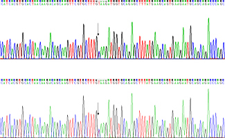 Test genètic BRCA1/2