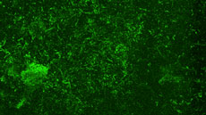 bacteris PLOS ONE Esther Julian