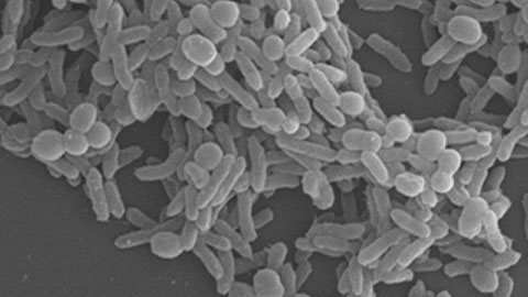 Imatge d'A. baumannii obtinguda per microscòpia electrònica