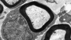 Màster oficial de Neurociències