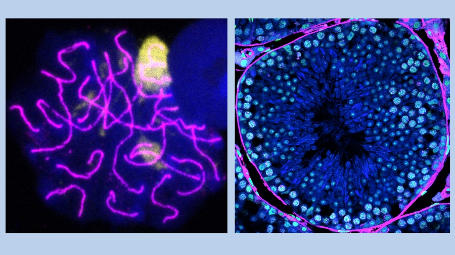 Imatges microscopia d'espermatozoides de ratolí