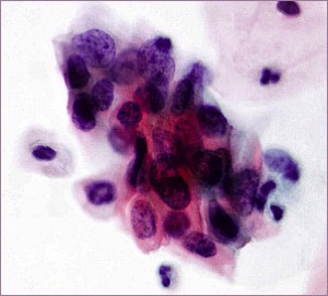 Ginecologia