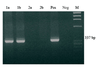 Primer cas d'avortament per Neospora caninum en un boví d'actitud càrnia