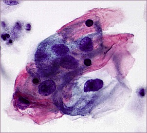 Ginecologia