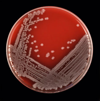 E. coli creixent en agar