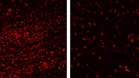  Microglial cells in an animal untrated brain region (left) and in treated animals (right)