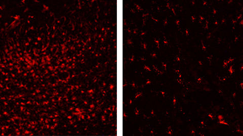 Microglial cells in an animal untrated brain region (left) and in treated animals (right)