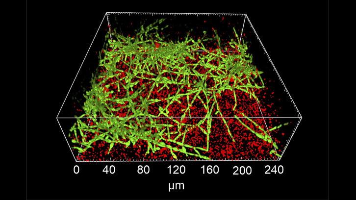 Biofilm mixto de dos bacteris