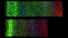 Estudian las funciones de la proteína PDK1 en las neuronas cerebrales de ratones