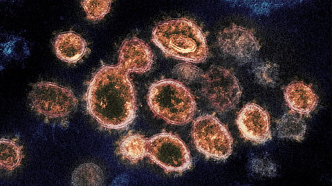 coronavirus