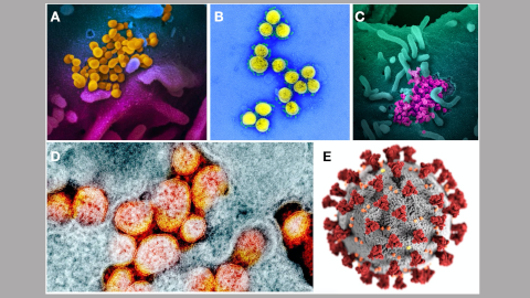 Coronavirus sars cov 2