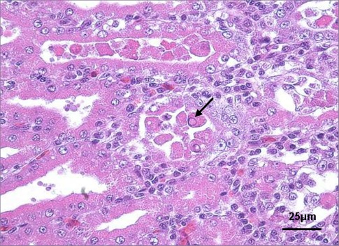 Proventriculitis