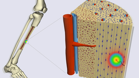 Bone repair ICN2