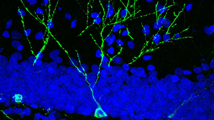 Neurones de l'hipocamp