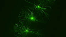 Màster oficial de Neurociències