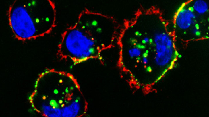 nanopartícules càncer mama