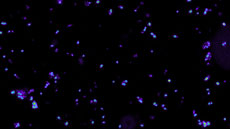 Micobacteris