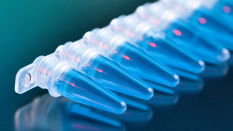 Foto genèrica estris laboratoris (pipetes)