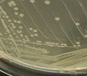 Esquerichia coli