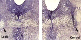 Nucli pedunculopòntic tegmental en el cervell de rata