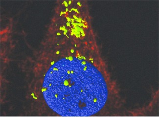 Teràpia gènica amb nanodiscs