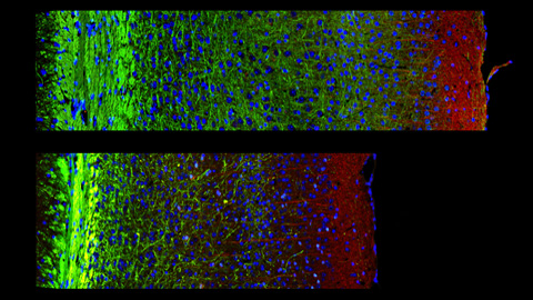 Estudian las funciones de la proteína PDK1 en las neuronas cerebrales de ratones