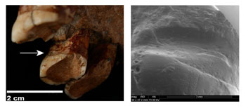 Els neandertals usaven escuradents per calmar el dolor de genives