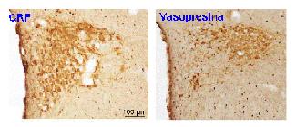 CRF i vasopressina