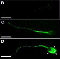 Receptors de dopamina en espermatozoides porcins