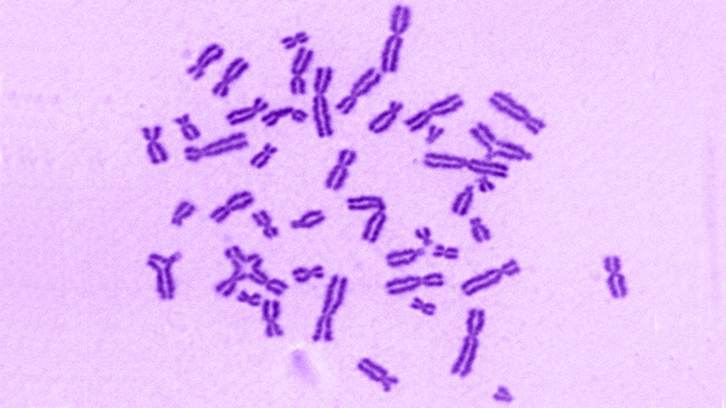 RFWD3 un nou gen que causa anèmia de Fanconi