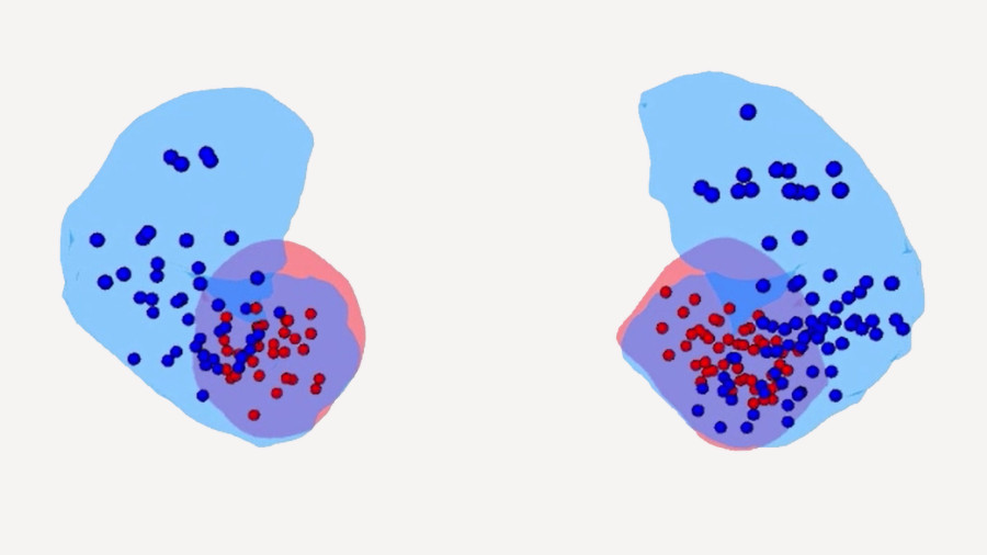Visualización de los electrodos