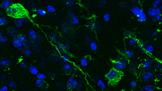 UAB Pioneers Study of the Memory Through Optogenetics