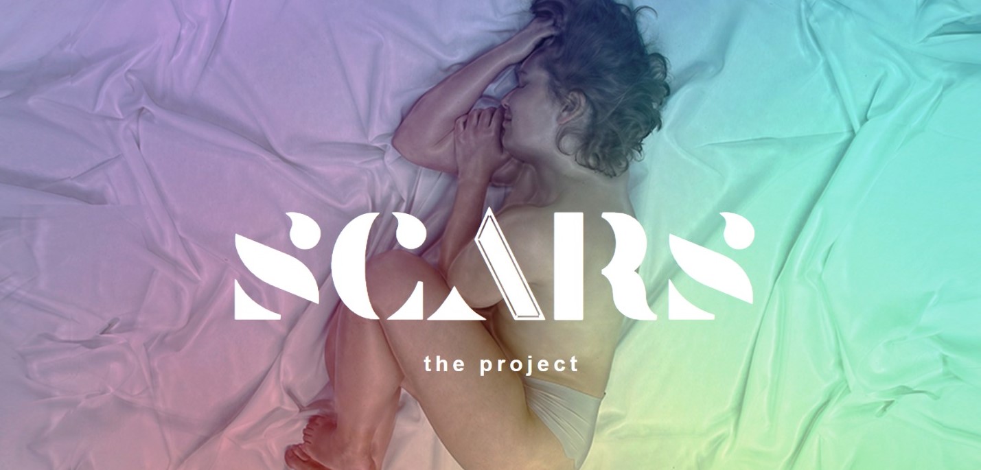 Scars the project