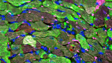 Imatge augmentada del cor. Les cèl·lules en color verd representen els cardiomiòcits que han estat s
