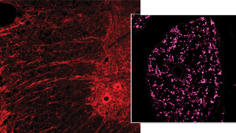 Descrit un nou fàrmac neuroprotector i accelerador de la regeneració nerviosa